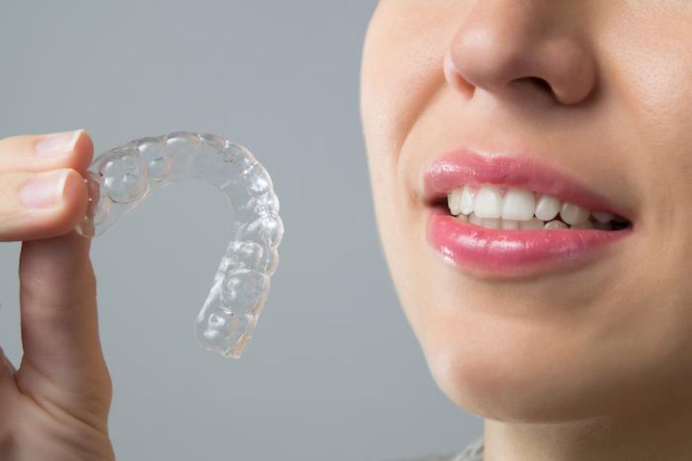 Is Invisalign Suitable for Teenagers?